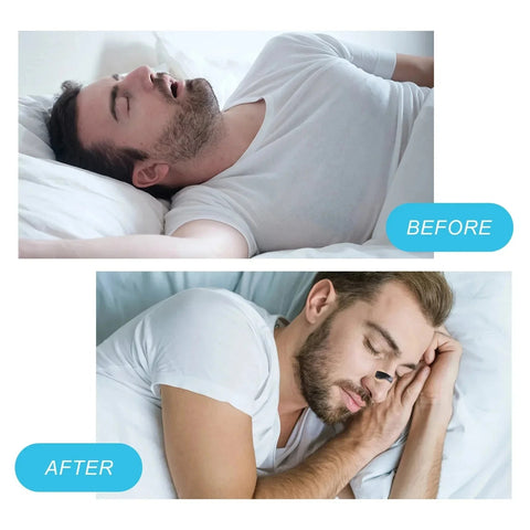 Magnetic Nasal Strips Kit For Easy Breathing