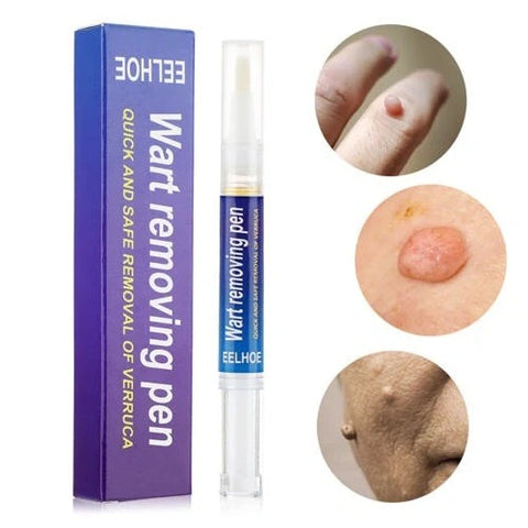Warts & Moles Remover Pen (14 Days Money Back Guarantee)