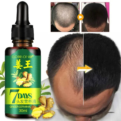 7 Days Ginger Hair Care Essential Oil