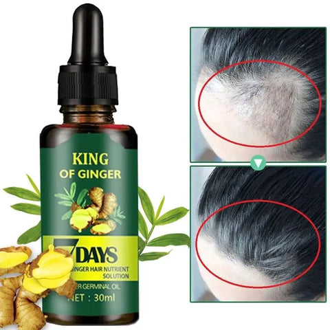 7 Days Ginger Hair Care Essential Oil