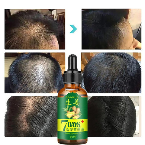 7 Days Ginger Hair Care Essential Oil
