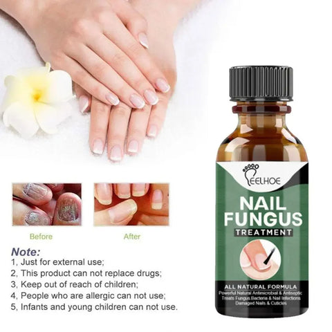 Nail Fungus Serum for Nails fungal Treatment and Repair Nails