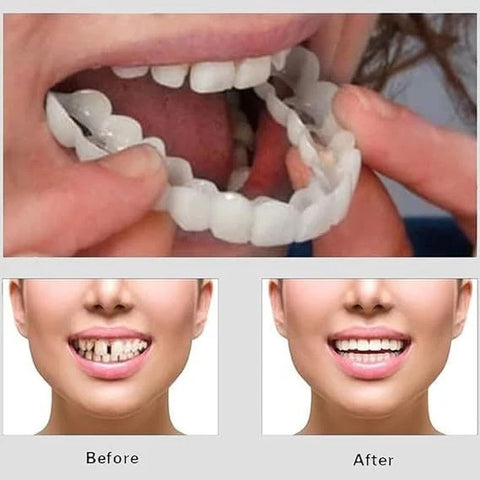 Silicone Imitation Braces Teeth Decoration Kits